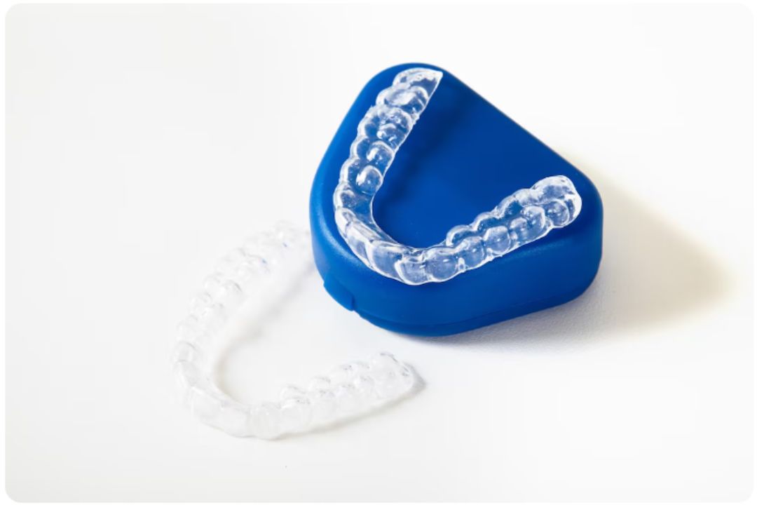 Clear Aligners Explained: Your Complete Step-by-Step Journey | Diagnopein