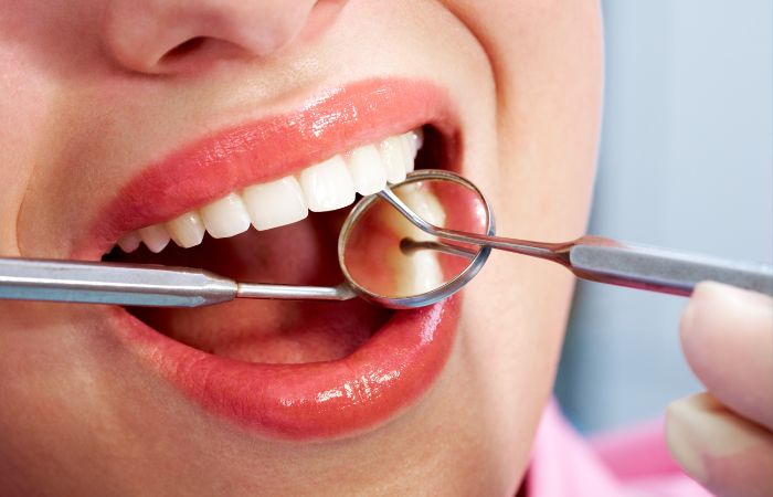 Dental Checkups Help in Maintaining Healthy Teeth | Diagnopein