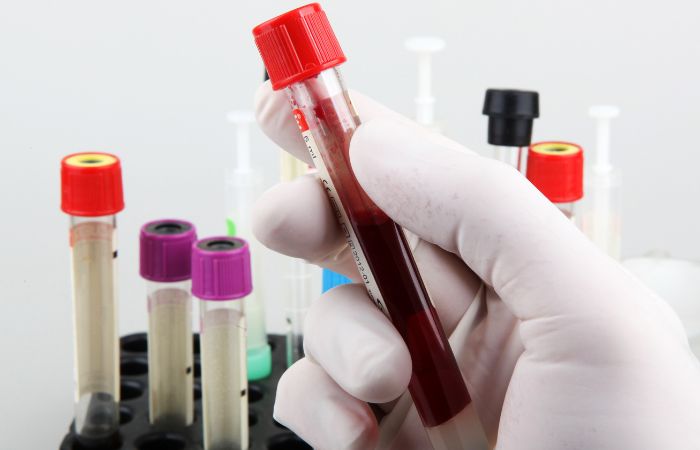 Dos and Don'ts For Blood Test | Diagnopein