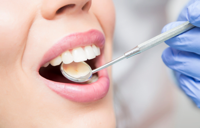 10 Signs You Need a Dental Check-Up | Diagnopein