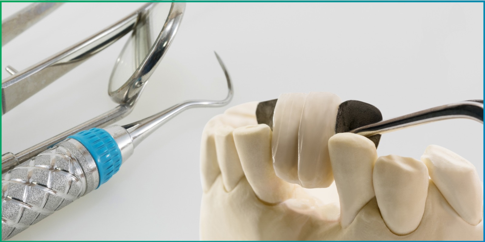 Dental Bridges in Pune | Best Tooth Replacement Treatment Near You