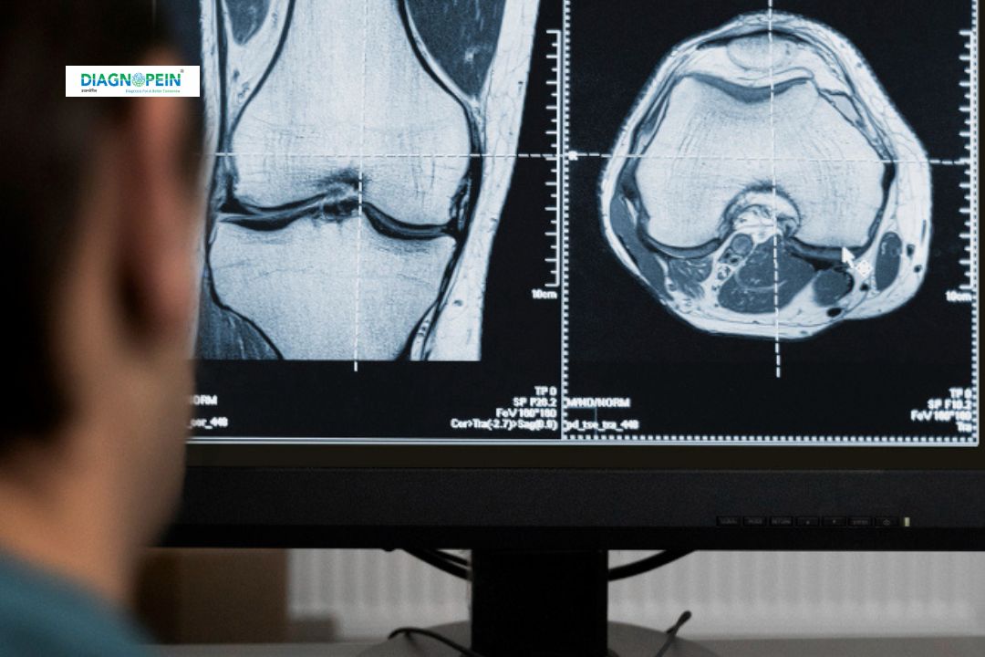 CT Chest Abdomen Pelvis Contrast Test | Whole Body CT Scan with Contrast