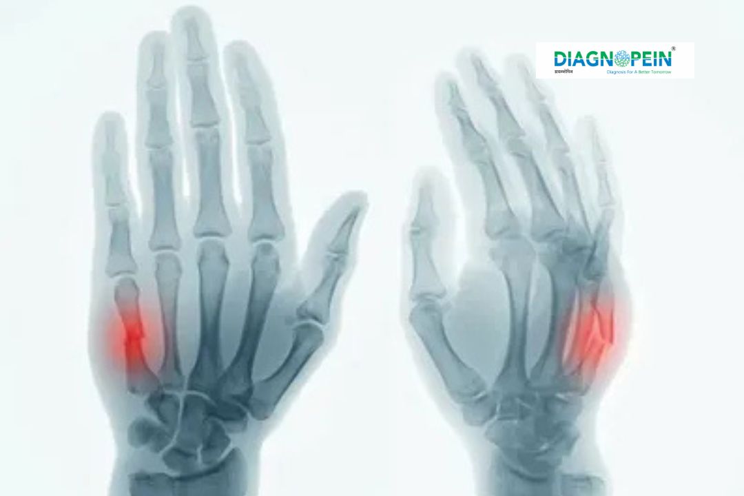 Hand X-Ray (AP, Lateral & Oblique Views) | Procedure, Benefits & Cost ...