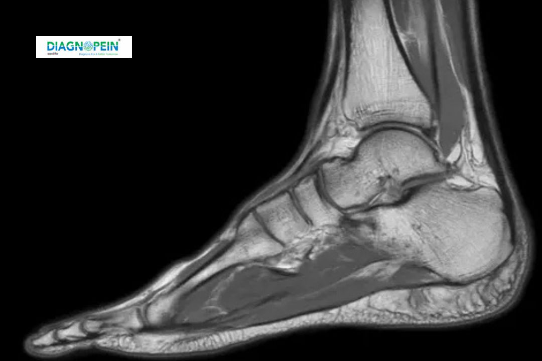 MRI Foot Scan in Nanded – Advanced Foot Imaging & Diagnosis