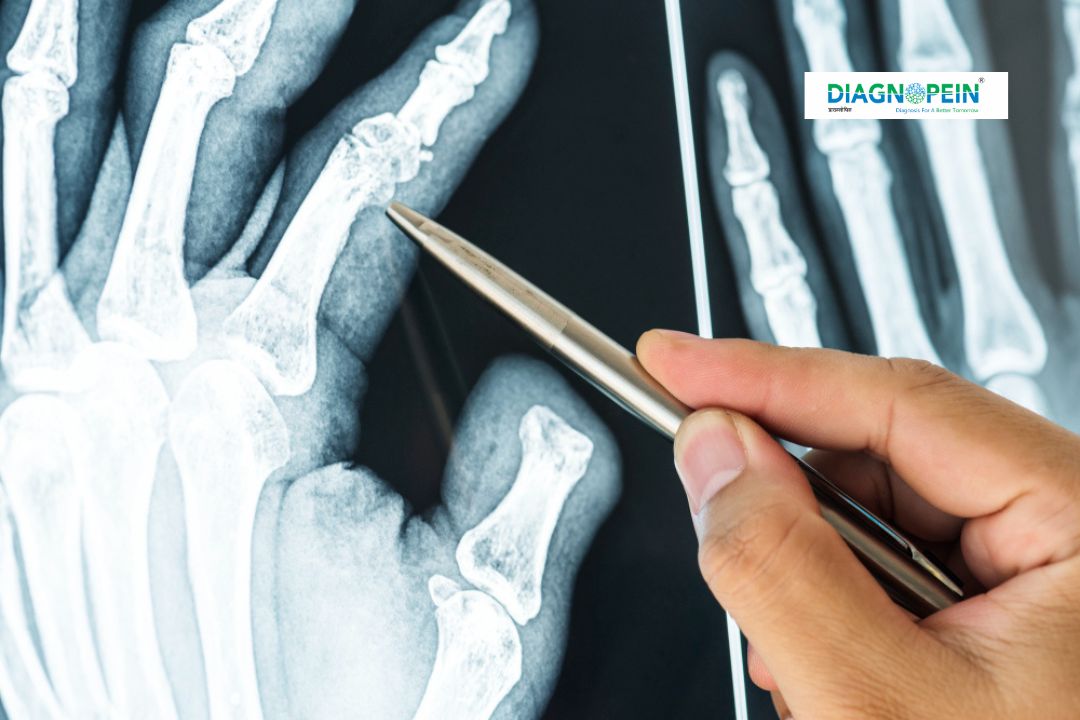 Ap Axial Inlet Radiograph Patella AP/Lateral/Axial View X-ray in Karad | Accurate Knee Imaging ...