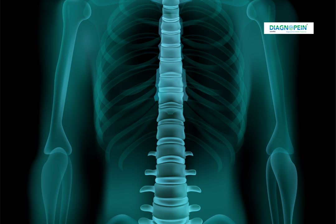 X-Ray Apicogram in Karad | Dental & Bone Imaging | Diagnopein