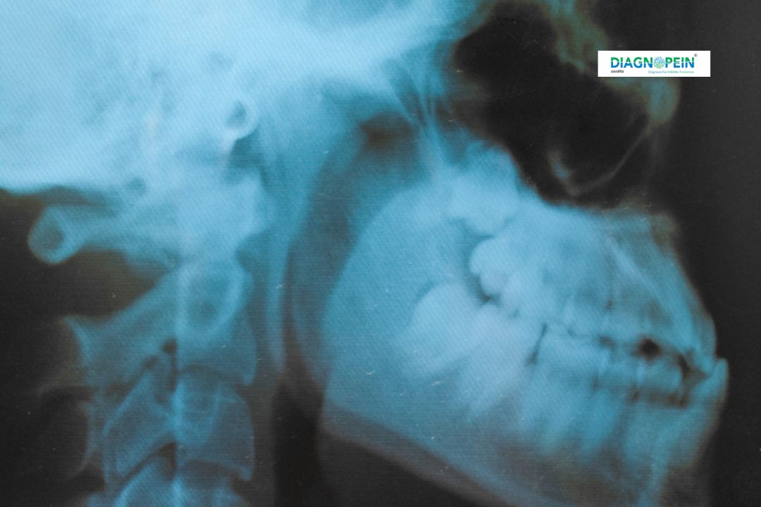 X-Ray LAT Cephalogram in Karad | Dental & Orthodontic X-Ray | Diagnopein