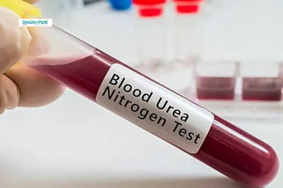 What Is Urea Nitrogen In Blood Test